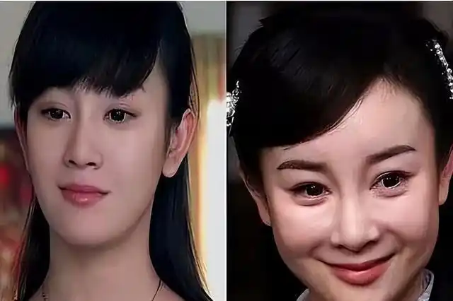 过度整容的这5位明星,脸部僵硬,表情不自然,无法继续演戏