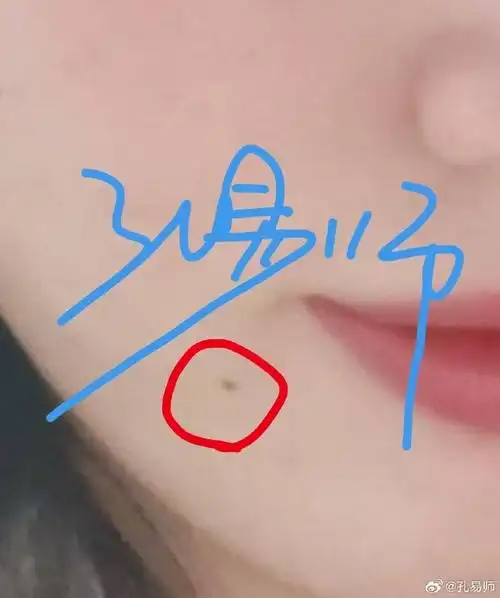 痣相嘴边痣多口舌是非,嘴角两边的,容易和同事,同学,同龄人有口舌是非