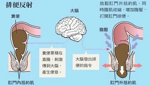 若我们的排便系统遭到破坏,会发生什么?