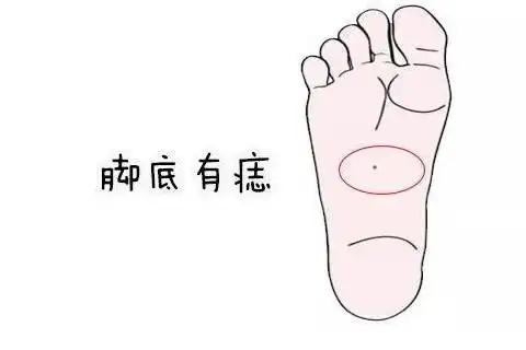 脚底板长痣的痣相图解_学搭配运势网