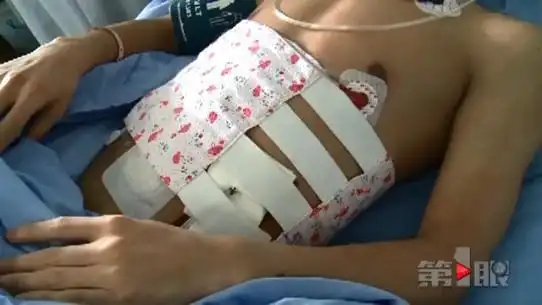 重庆一小伙朝腹部横切一刀 血肉模糊惨不忍睹