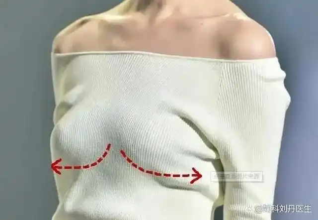 为什么女性喂奶后"双峰"下垂?