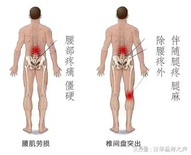 百草益寿学会古法通背不花一分钱赶走腰间盘突出腰肌劳损