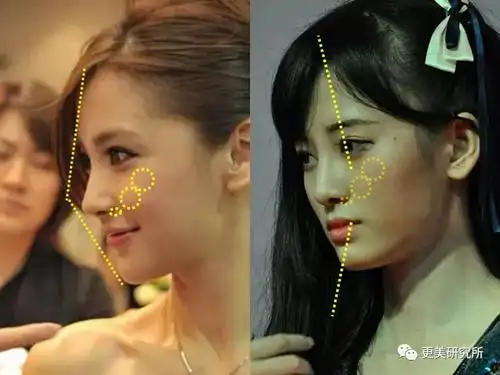 这也就导致了她的这张脸干瘪与扁平并存.