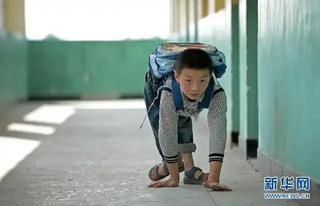 蜗牛男孩"艰辛上学路(组图)