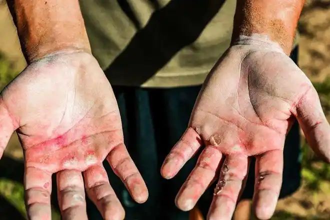 一张受伤士兵的照片,感动百万网友!