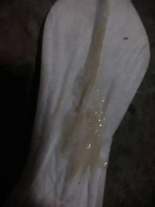 正常的白带形态的图片