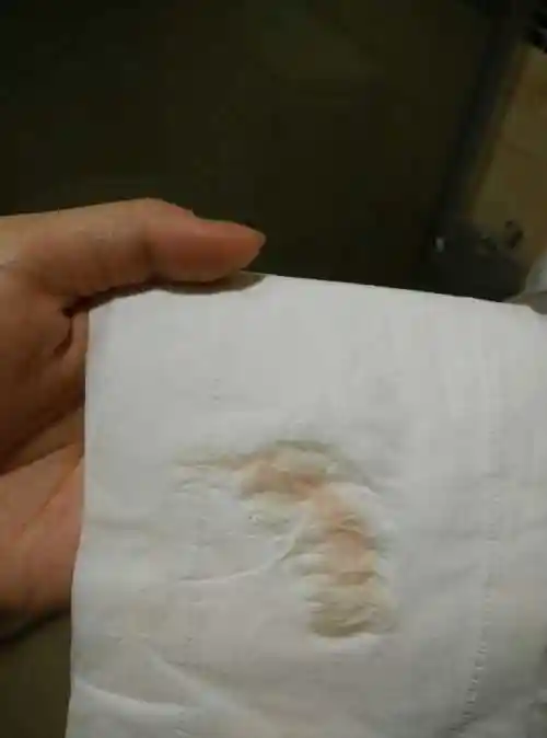 刚怀孕29天出血怎么回事