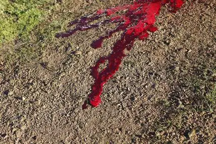 地板上有血迹照片