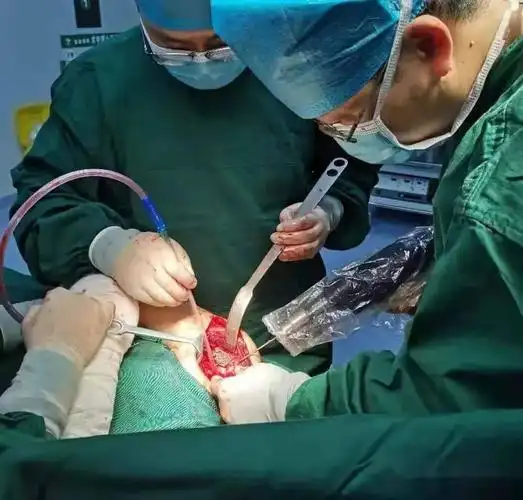 田林县中医医院外科手术案例