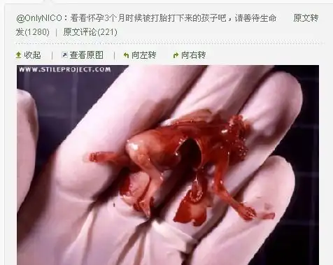 这个是三个月的宝宝.已经成形了,你自己想想看,肯定是用什么来夹的.