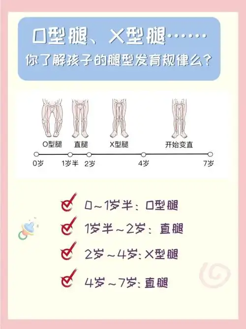 宝宝的o型腿真的需要矫正么?腿部发育过程97