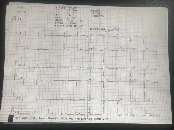 张强体检报告2018/12/10