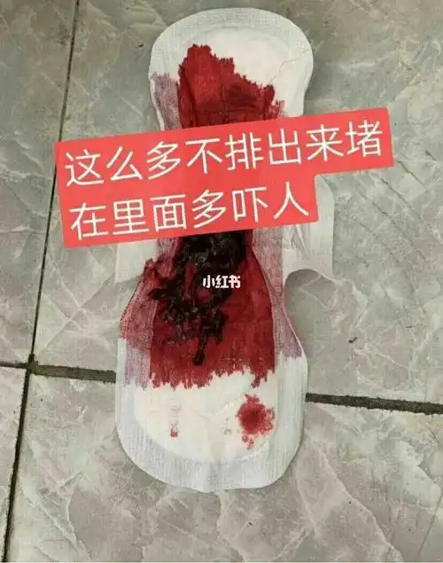 以前的我月经量少的可怜用护垫都能搞定,2天就干净,以为年纪轻轻就要