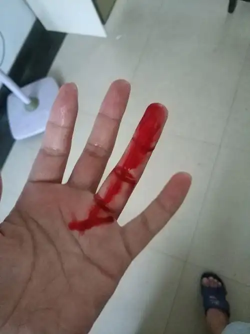 女生切菜切到手的图片