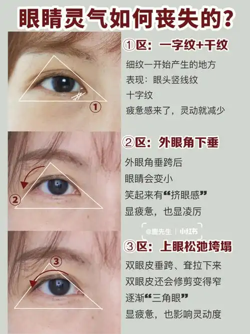 11566眼神呆滞,缺乏光芒感21566皮肤不错,但还是一眼看出年龄