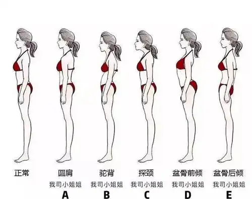 明星们出现的体态问题你踩雷了么?