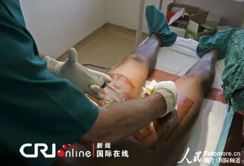 揭秘世界各地男子割礼仪式组图