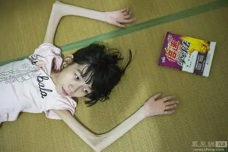 脊肌萎缩症女孩的生活:拥有不会"萎缩"的梦想