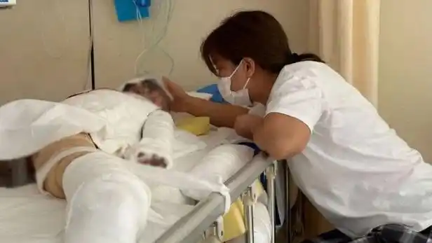 煤气燃爆致女童全身90烧伤却还关心着爸爸疼不疼