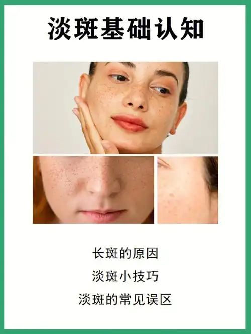 淡化呢今天就和大家分享一下关于淡 斑的知识166长斑的原因266淡