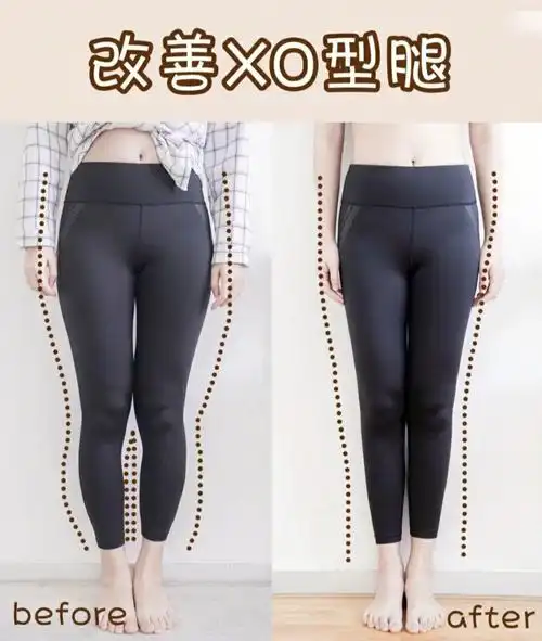 一月轻松改善xo型腿