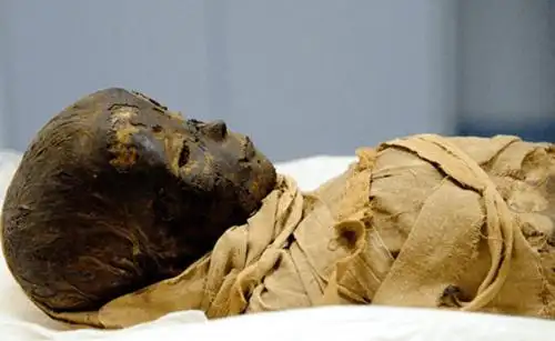 八旬老太怀孕46年后产下木乃伊太神奇了