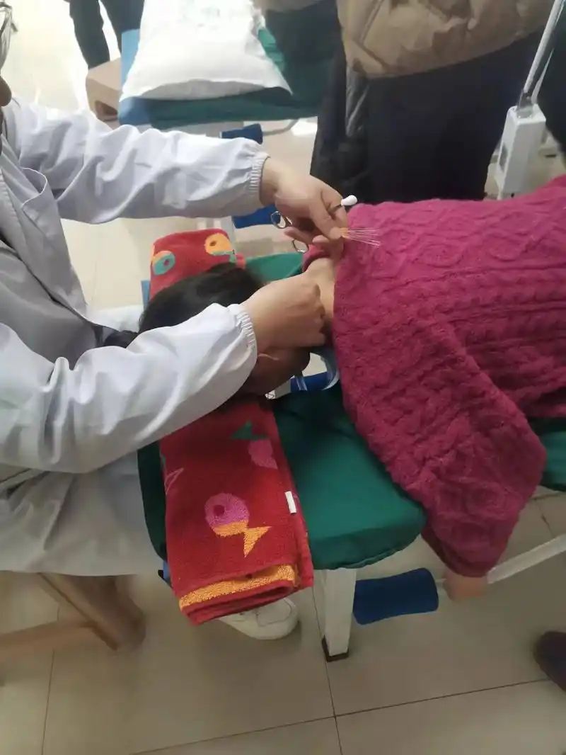 颈椎病针灸第三天.颈椎病针灸第三天,之前在合肥的安医附院,安 - 抖音