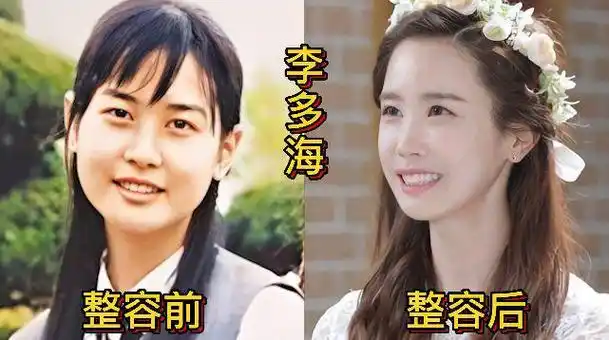 18位韩国女星整容前后对比|圆脸|单眼皮|鹅蛋脸|李多海|韩彩英_网易