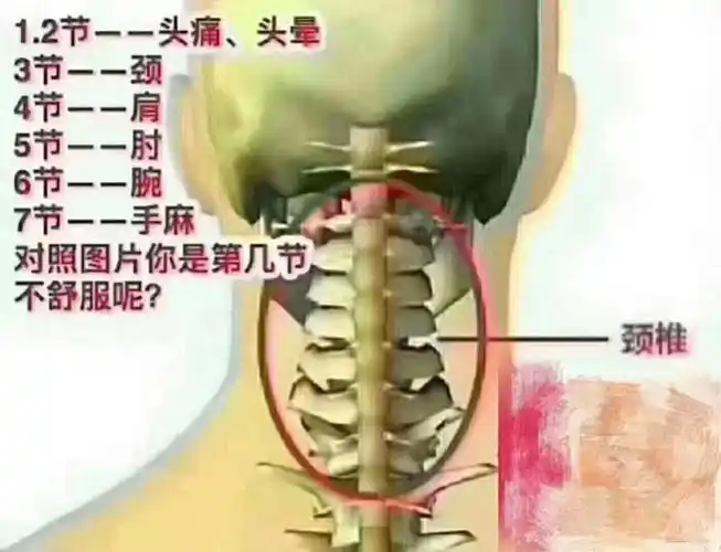 教你赶走富贵包&颈椎病~ - 美篇