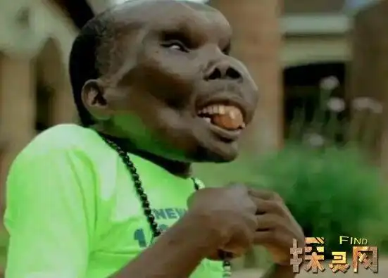 吉尼斯纪录最丑的男人唐全书畸形脸丑出了新高度以丑为荣