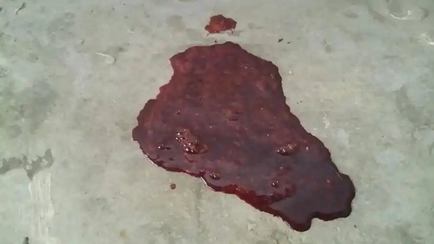 萨摩耶还有一个月就一岁了,现在上吐下泻,泻的都是血,肚子都瘦的没有