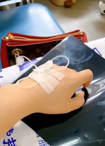 女孩子自己去输液的时候请记住,最好用左手