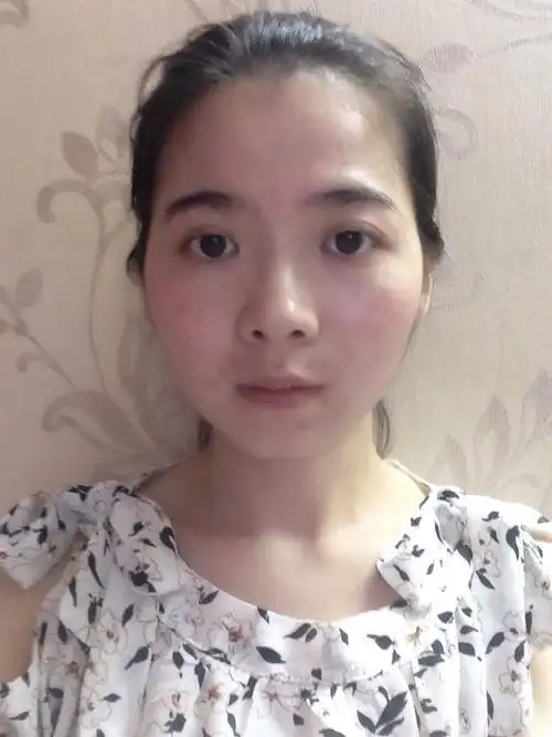 我的额头窄,请问留空气刘海适合吗?我平常都是中分的,现在想换个发型