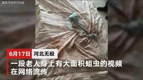 原创触目惊心!敬老院老人浑身溃烂生蛆,足跟伤口深可见骨