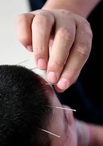 在位于河南省汝州市的金庚医院,宋兆普在为一名患儿进行针灸治疗(2016