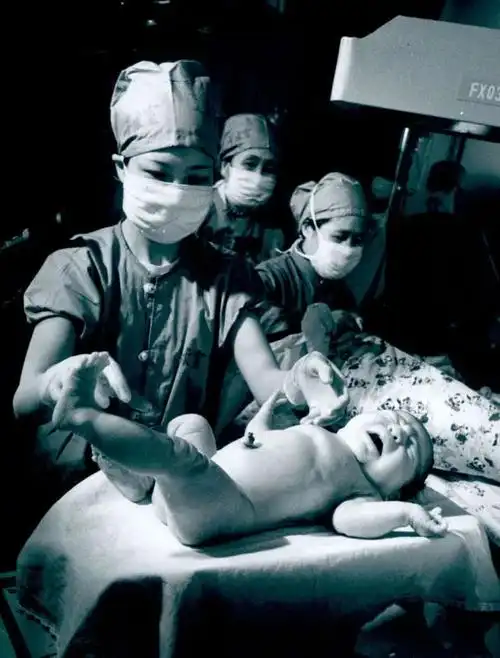 大陆首例试管婴儿降生,孙玉良摄,曾获当年《北京日报》新闻摄影一等奖