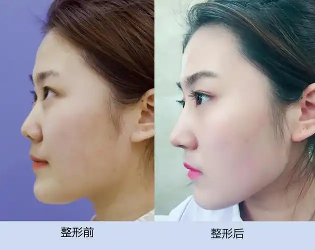 那你首先得有个精致的鼻子