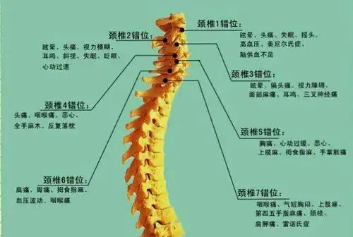 颈椎病最大的危害不是疼痛,而是并发症