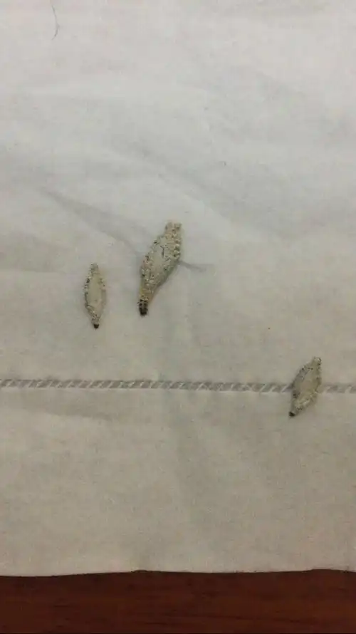 什么情况下生这个虫.怎么消灭?茧里面都是头发灰尘