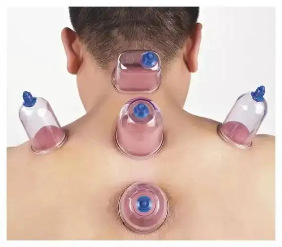 拔罐治疗肩周炎效果出人意料少有人知道