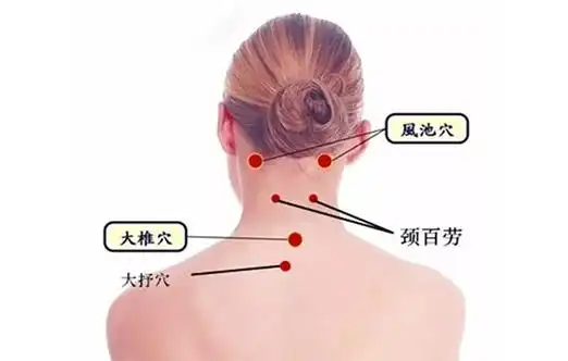 对抗低头族的"痛" 这一个穴位就能解颈痛