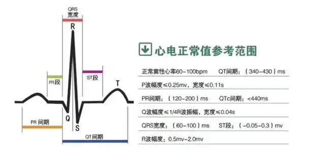 益体康hc-201便携式心电图机标准版家用心电监测仪(监护仪)正品