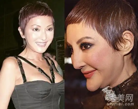 各国整形失败的女明星