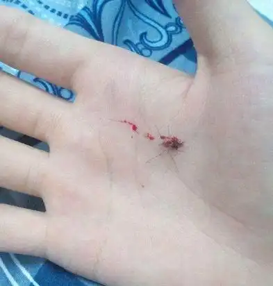 梦见打死蚊子满手是血