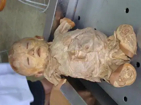 解剖实习课. - michelle tong - michelletong