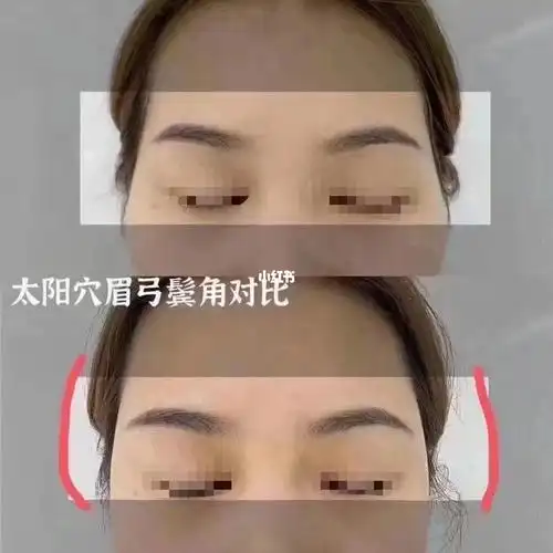 太阳穴就是夫妻宫 太阳穴凹陷,面相显凶 风水上影响夫妻感情 饱满之后