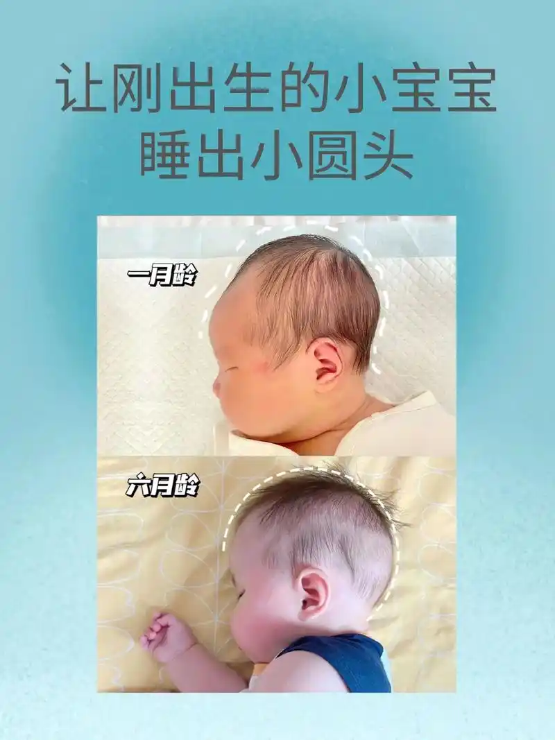 教你如何给宝宝睡出好看的小圆头.