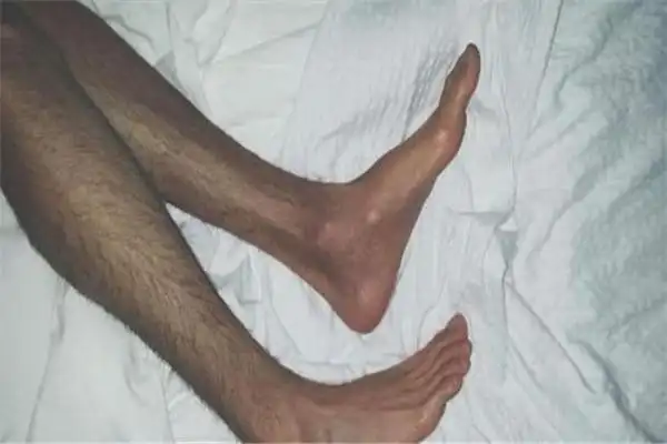 男生腿毛能刮吗