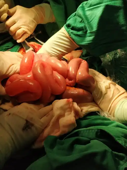 拉肚子便秘的真正原因!